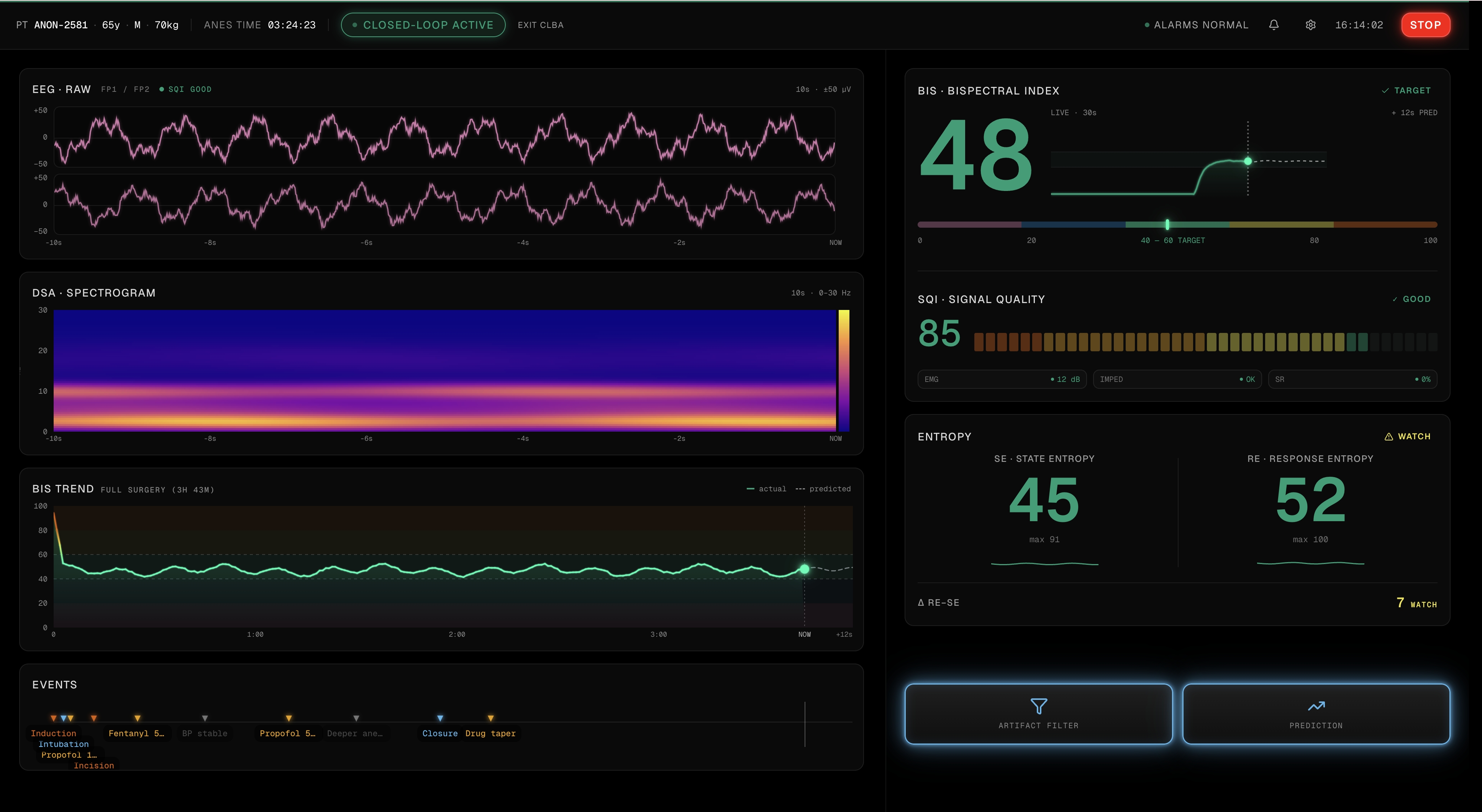 麻醉程度分析 Dashboard